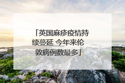 英国麻疹疫情持续蔓延 今年来伦敦病例数最多