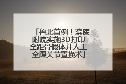 鲁北首例！滨医附院实施3D打印全距骨假体并人工全踝关节置换术